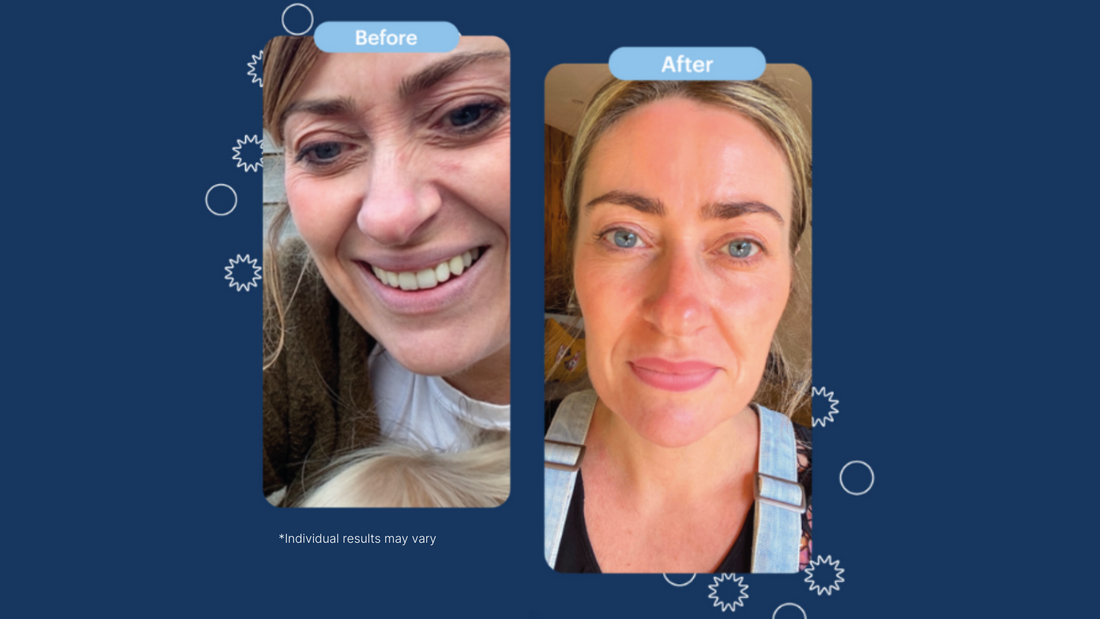 Skin Journey: Nicola Green